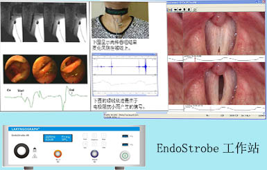 吞咽評估系統(tǒng) EndoStrobe